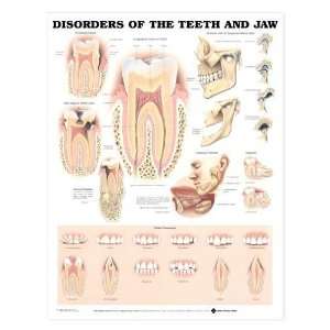  Teeth Jaw Disorders Chart Industrial & Scientific