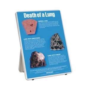  Death of a Lung Easel Display Arts, Crafts & Sewing