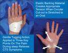 CARPAL SOLUTION Carpal Tunnel Treatment 6 Week RIGHT