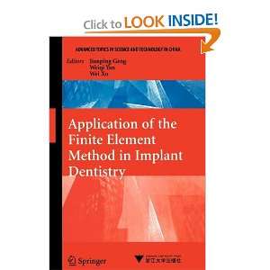   the Finite Element Method in Implant Dentistry (9783540868170) Books