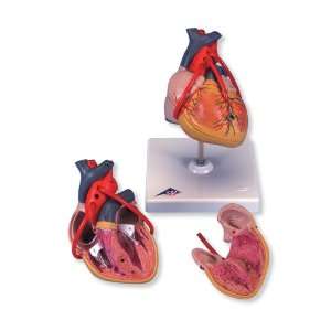    3B Scientific Classic Heart with Bypass